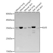 Western blot analysis of various lysates using KLK5 Antibody at 1/500 dilution. Secondary antibody: HRP-conjugated Goat anti-Rabbit IgG (H+L) at 1/10000 dilution. Lysates/proteins: 25 µg per lane. Blocking buffer: 3% nonfat dry milk in TBST. Exposure time: 3s.