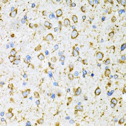 Low Density Lipoprotein Receptor Related Protein Associated Protein 1 (LRPAP1) Antibody