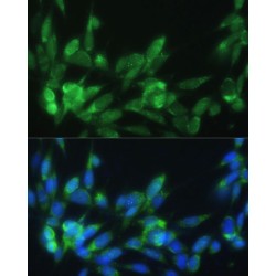 Low Density Lipoprotein Receptor Related Protein Associated Protein 1 (LRPAP1) Antibody