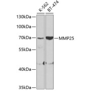 Western blot analysis of various lysates using MMP25 Antibody at 1/400 dilution. Secondary antibody: HRP-conjugated Goat anti-Rabbit IgG (H+L) at 1/10000 dilution. Lysates/proteins: 25 µg per lane. Blocking buffer: 3% nonfat dry milk in TBST.