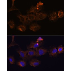 Matrix Metalloproteinase 25 (MMP25) Antibody