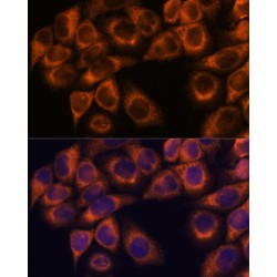 Matrix Metalloproteinase 25 (MMP25) Antibody