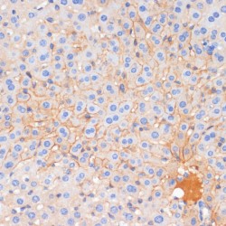 Cadherin-1 (CDH1) Antibody