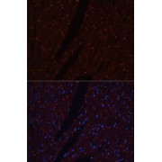 Western blot analysis of lysates from Mouse heart using N-Cadherin Antibody at 1/1000 dilution. Secondary antibody: HRP-conjugated Goat anti-Rabbit IgG (H+L) at 1/10000 dilution. Lysates/proteins: 25 µg per lane. Blocking buffer: 3% nonfat dry milk in TBST. Exposure time:30s.