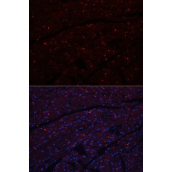 Cadherin, Neuronal (CDH2) Antibody