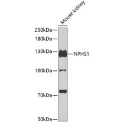 Western blot analysis of lysates from mouse kidney, using NPHS1 Antibody at 1/500 dilution. Secondary antibody: HRP-conjugated Goat anti-Rabbit IgG (H+L) at 1/10000 dilution. Lysates/proteins: 25 µg per lane. Blocking buffer: 3% nonfat dry milk in TBST. Exposure time: 90s.