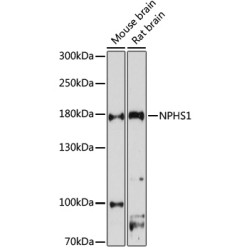 NPHS1, Nephrin (NPHS1) Antibody