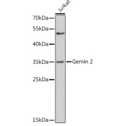 Western blot analysis of lysates from Jurkat cells, using Gemin 2 Antibody at 1/500 dilution. Secondary antibody: HRP-conjugated Goat anti-Rabbit IgG (H+L) at 1/10000 dilution. Lysates/proteins: 25 µg per lane. Blocking buffer: 3% nonfat dry milk in TBST. Exposure time: 90s.