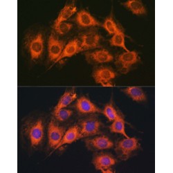 Pituitary Adenylate Cyclase-Activating Polypeptide Type I Receptor (ADCYAP1R1) Antibody