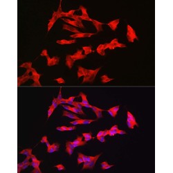 Pituitary Adenylate Cyclase-Activating Polypeptide Type I Receptor (ADCYAP1R1) Antibody