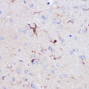 Immunohistochemistry analysis of paraffin-embedded Rat brain using AIF1/IBA1 Antibody at dilution of 1/50 (40x lens). Microwave antigen retrieval performed in 0.01 M PBS Buffer (pH 7.2) prior to IHC staining.