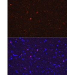 Allograft Inflammatory Factor 1 (AIF1) Antibody