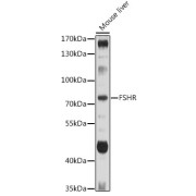 Western blot analysis of lysates from Mouse liver, using FSHR Antibody at 1/1000 dilution. Secondary antibody: HRP-conjugated Goat anti-Rabbit IgG (H+L) at 1/10000 dilution. Lysates/proteins: 25 µg per lane. Blocking buffer: 3% nonfat dry milk in TBST. Exposure time: 30s.