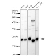 Western blot analysis of various lysates, using PPIF Antibody at 1/600 dilution. Secondary antibody: HRP-conjugated Goat anti-Rabbit IgG (H+L) at 1/10000 dilution. Lysates/proteins: 25 µg per lane. Blocking buffer: 3% nonfat dry milk in TBST. Exposure time: 30s.