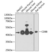 Western blot analysis of lysates from wild type (WT) and 293F cells transfected with CD8B using CD8B Antibody at 1/500 dilution. Secondary antibody: HRP-conjugated Goat anti-Rabbit IgG (H+L) at 1/10000 dilution. Lysates/proteins: 25 µg per lane. Blocking buffer: 3% nonfat dry milk in TBST. Exposure time: 10s.