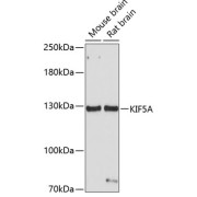 Western blot analysis of various lysates using KIF5A Antibody at 1/1000 dilution. Secondary antibody: HRP-conjugated Goat anti-Rabbit IgG (H+L) at 1/10000 dilution. Lysates/proteins: 25 µg per lane. Blocking buffer: 3% nonfat dry milk in TBST. Exposure time: 30s.