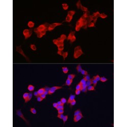 Kinesin Family Member 5A (KIF5A) Antibody