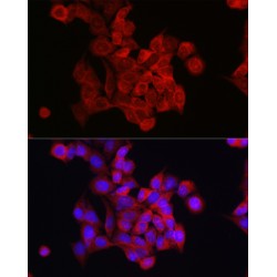 Forkhead Box Protein O4 (FOXO4) Antibody