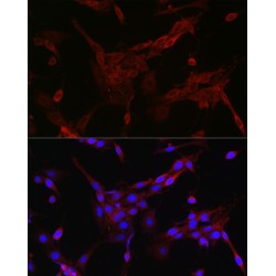 Forkhead Box Protein O4 (FOXO4) Antibody