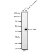 Western blot analysis of lysates from wild type (WT) and 293T cells transfected with SLC39A4 using SLC39A4 Antibody at 1/2000 dilution. Secondary antibody: HRP-conjugated Goat anti-Rabbit IgG (H+L) at 1/10000 dilution. Lysates/proteins: 25 µg per lane. Blocking buffer: 3% nonfat dry milk in TBST. Exposure time: 30s.