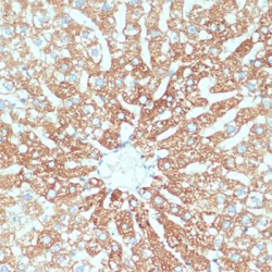 Zinc Transporter ZIP4 (SLC39A4) Antibody