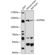 Western blot analysis of various lysates using SLITRK6 Antibody at 1/1000 dilution. Secondary antibody: HRP-conjugated Goat anti-Rabbit IgG (H+L) at 1/10000 dilution. Lysates/proteins: 25 µg per lane. Blocking buffer: 3% nonfat dry milk in TBST. Exposure time: 60s.