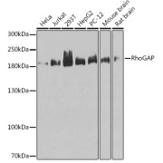 Western blot analysis of various lysates using RhoGAP Antibody at 1/1000 dilution. Secondary antibody: HRP-conjugated Goat anti-Rabbit IgG (H+L) at 1/10000 dilution. Lysates/proteins: 25 µg per lane. Blocking buffer: 3% nonfat dry milk in TBST. Exposure time: 60s.