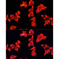 Rho GTPase Activating Protein 5 (ARHGAP5) Antibody