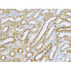 Aconitate Hydratase, Mitochondrial (ACO2) Antibody