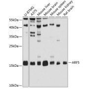 Western blot analysis of various lysates using ARF5 Antibody at 1/1000 dilution. Secondary antibody: HRP-conjugated Goat anti-Rabbit IgG (H+L) at 1/10000 dilution. Lysates/proteins: 25 µg per lane. Blocking buffer: 3% nonfat dry milk in TBST. Exposure time: 10s.