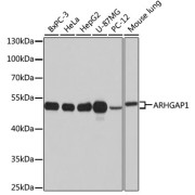 Western blot analysis of various lysates using ARHGAP1 Antibody at 1/1000 dilution. Secondary antibody: HRP-conjugated Goat anti-Rabbit IgG (H+L) at 1/10000 dilution. Lysates/proteins: 25 µg per lane. Blocking buffer: 3% nonfat dry milk in TBST. Exposure time: 15s.