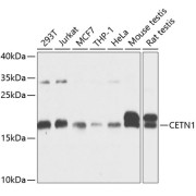 Western blot analysis of various lysates using CETN1 Antibody at 1/1000 dilution. Secondary antibody: HRP-conjugated Goat anti-Rabbit IgG (H+L) at 1/10000 dilution. Lysates/proteins: 25 µg per lane. Blocking buffer: 3% nonfat dry milk in TBST. Exposure time: 10s.