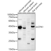 Western blot analysis of various lysates using CPA1 Antibody at 1/1000 dilution. Secondary antibody: HRP-conjugated Goat anti-Rabbit IgG (H+L) at 1/10000 dilution. Lysates/proteins: 25 µg per lane. Blocking buffer: 3% nonfat dry milk in TBST. Exposure time: 180s.