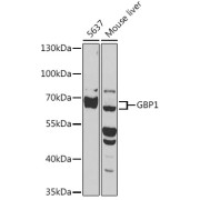 Western blot analysis of various lysates using GBP1 Antibody at 1/1000 dilution. Secondary antibody: HRP-conjugated Goat anti-Rabbit IgG (H+L) at 1/10000 dilution. Lysates/proteins: 25 µg per lane. Blocking buffer: 3% nonfat dry milk in TBST. Exposure time: 10s.