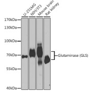 Western blot analysis of various lysates using Glutaminase (GLS) Antibody at 1/1000 dilution. Secondary antibody: HRP-conjugated Goat anti-Rabbit IgG (H+L) at 1/10000 dilution. Lysates/proteins: 25 µg per lane. Blocking buffer: 3% nonfat dry milk in TBST. Exposure time: 30s.