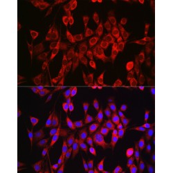 Glutaminase (GLS) Antibody