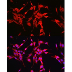 Glutaminase (GLS) Antibody