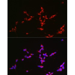 Glutaminase (GLS) Antibody