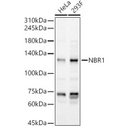 Western blot analysis of various lysates, using NBR1 Antibody at 1/400 dilution. Secondary antibody: HRP-conjugated Goat anti-Rabbit IgG (H+L) at 1/10000 dilution. Lysates/proteins: 25 µg per lane. Blocking buffer: 3% nonfat dry milk in TBST. Exposure time: 60s.