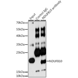 NADH Ubiquinone Oxidoreductase Subunit B10 (NDUFB10) Antibody