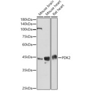 Western blot analysis of various lysates using PDK2 Antibody at 1/3000 dilution. Secondary antibody: HRP-conjugated Goat anti-Rabbit IgG (H+L) at 1/10000 dilution. Lysates/proteins: 25 µg per lane. Blocking buffer: 3% nonfat dry milk in TBST. Exposure time: 10s.