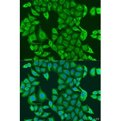 Pyruvate Dehydrogenase Kinase Isozyme 2 (PDK2) Antibody