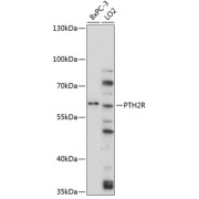 Western blot analysis of various lysates using PTH2R Antibody at 1/3000 dilution. Secondary antibody: HRP-conjugated Goat anti-Rabbit IgG (H+L) at 1/10000 dilution. Lysates/proteins: 25 µg per lane. Blocking buffer: 3% nonfat dry milk in TBST. Exposure time: 10s.