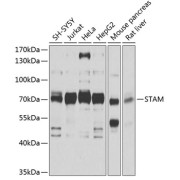 Western blot analysis of various lysates using STAM Antibody at 1/1000 dilution. Secondary antibody: HRP-conjugated Goat anti-Rabbit IgG (H+L) at 1/10000 dilution. Lysates/proteins: 25 µg per lane. Blocking buffer: 3% nonfat dry milk in TBST. Exposure time: 15s.