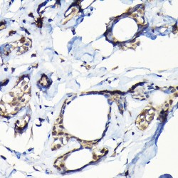 Ubiquitin Specific Peptidase 5 (USP5) Antibody