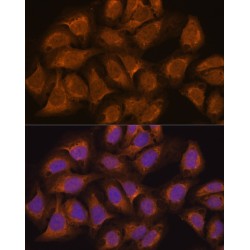 Ubiquitin Specific Peptidase 5 (USP5) Antibody