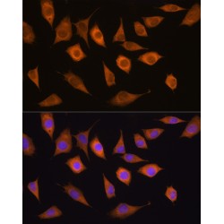 Ubiquitin Specific Peptidase 5 (USP5) Antibody