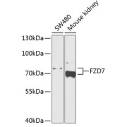 Western blot analysis of various lysates using FZD7 Antibody at 1/1000 dilution. Secondary antibody: HRP-conjugated Goat anti-Rabbit IgG (H+L) at 1/10000 dilution. Lysates/proteins: 25 µg per lane. Blocking buffer: 3% nonfat dry milk in TBST. Exposure time: 90s.