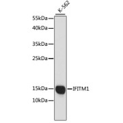 Western blot analysis of lysates from K-562 cells, using CD225/IFITM1 Antibody at 1/1000 dilution. Secondary antibody: HRP-conjugated Goat anti-Rabbit IgG (H+L) at 1/10000 dilution. Lysates/proteins: 25 µg per lane. Blocking buffer: 3% nonfat dry milk in TBST. Exposure time: 90s.