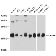 Western blot analysis of various lysates using VAMP4 Antibody at 1/1000 dilution. Secondary antibody: HRP-conjugated Goat anti-Rabbit IgG (H+L) at 1/10000 dilution. Lysates/proteins: 25 µg per lane. Blocking buffer: 3% nonfat dry milk in TBST. Exposure time: 10s.